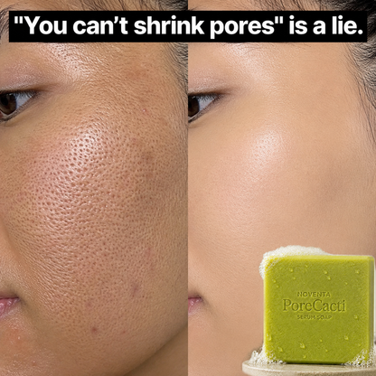 PoreCacti™ Serum Soap