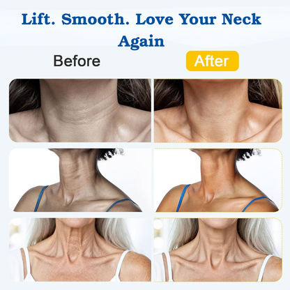 NeckReve™ Anti-Aging Cream