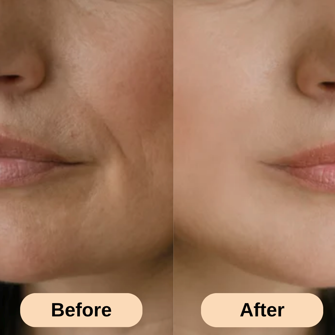 ReviaSkin™ Silicone Scar Stick