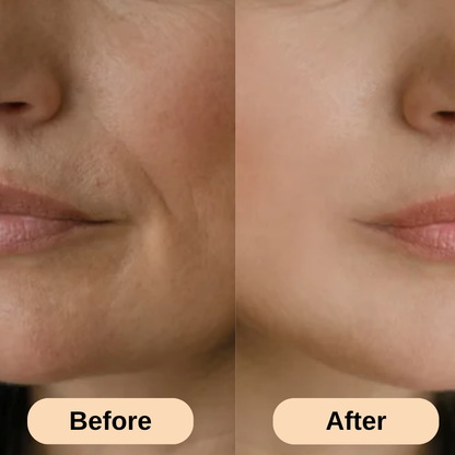 ReviaSkin™ Silicone Scar Stick